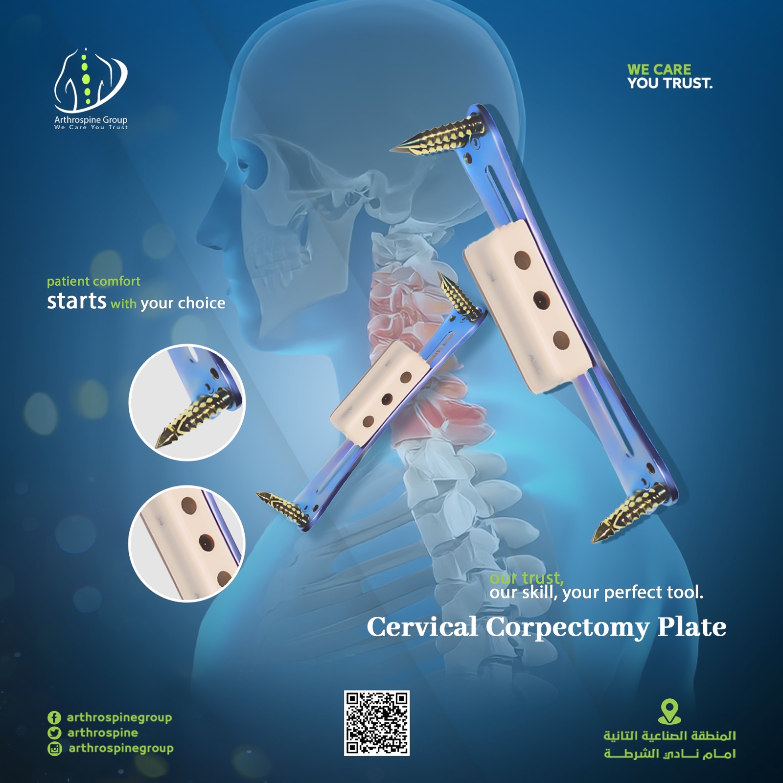 Cervical Corpectomy Plate